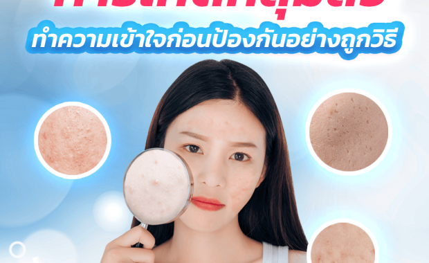 สาเหตุและกลไกการเกิดหลุมสิว – ทำความเข้าใจก่อนป้องกันอย่างถูกวิธี (H1)