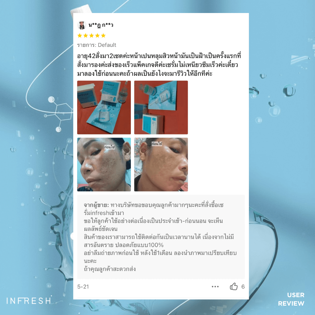 น**ฎ ก**ว